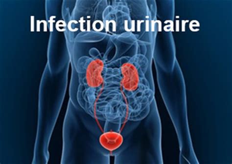 méat urétral|Méat urinaire : femme, homme, schéma, inflammation